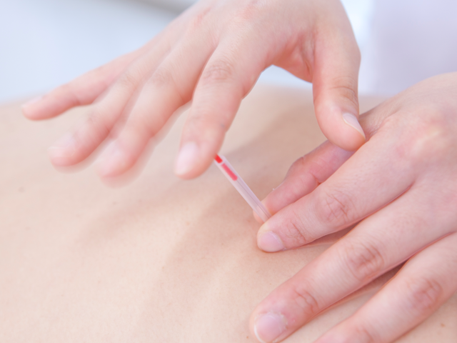 ていねいな施術
シーン