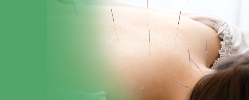 健康鍼灸サービスのテーマ画像